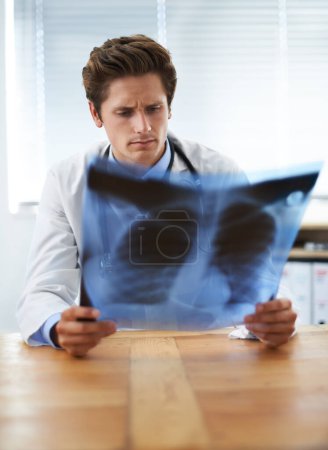 Téléchargez les photos : Homme médecin au bureau et vérifier les rayons X, les soins de santé avec diagnostic médical et examen de l'analyse pulmonaire à la clinique de cardiologie. Radiologie, pensée du chirurgien en doute après évaluation des résultats par IRM. - en image libre de droit