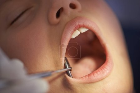 Photo for Closeup, child and dentist with mirror in mouth for gum disease and oral hygiene with dental inspection. Medical, orthodontics and consultation for teeth health, cleaning and wellness with instrument. - Royalty Free Image