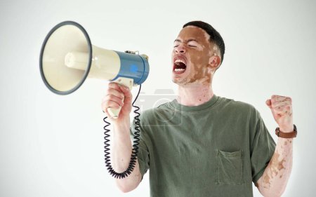 Sprechen Sie, auch wenn Ihre Stimme zittert. Studioaufnahme eines jungen Mannes mit Vitiligo mit einem Megafon vor weißem Hintergrund