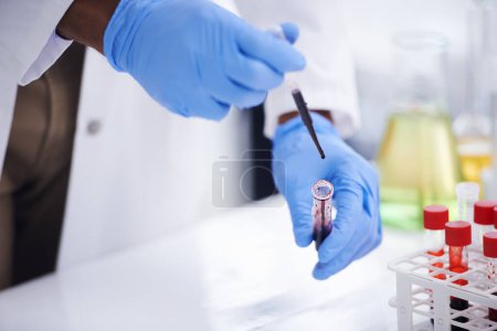 Photo for Hands, pipette and test tube for blood in laboratory, biological sample and biochemistry for pathology. Closeup, vial and DNA research for healthcare, RNA and process for medical innovation study. - Royalty Free Image
