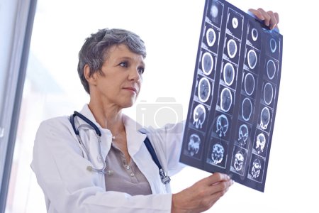 Photo for Woman, mature doctor and review xray for planning medical treatment, surgery and healthcare at hospital. Brain scan, neurology and radiology with surgeon for health assessment, anatomy and MRI. - Royalty Free Image