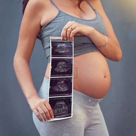 Photo for Mother, pregnancy and ultrasound in studio with belly for gender reveal, album and baby shower. Woman, child and sonogram isolated on gray background for maternity shoot, surrogacy and adoption. - Royalty Free Image