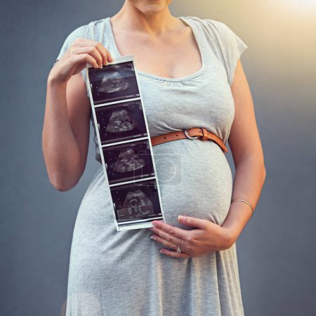 Photo for Woman, pregnant and child ultrasound in studio for maternity shoot, album and baby shower. Mother, expecting and sonogram isolated on gray background for gender reveal, surrogacy and legal adoption. - Royalty Free Image