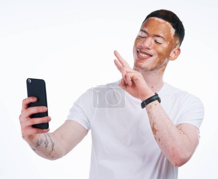 Photo for Happy man, vitiligo and selfie with peace sign for memory, picture or photography on a white studio background. Young or handsome male person with smile or emoji for capture, moment or social media. - Royalty Free Image