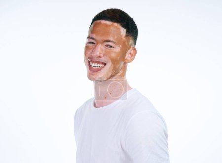 Photo for Happy, handsome and portrait of man with vitiligo or skin pigmentation on a white studio background. Face of unique and confident male person or albino with smile for melanin condition or mixed tone. - Royalty Free Image