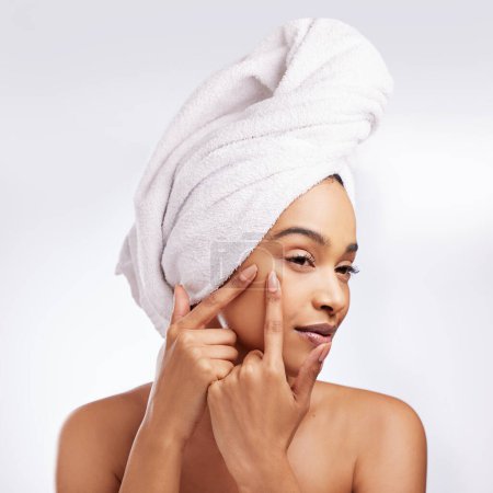 Skincare, pimple and hand of woman in studio for cosmetics, natural or blemish treatment on white background. Spa, body and female model with towel for popping zit, acne breakout or wellness routine.