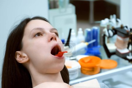 Mujer con impresión de moho de prótesis en mandíbula inferior en odontología para crear una prótesis. Tratamiento ortodoncista en odontología, prótesis dentales. Tomando impresiones para crear carillas.