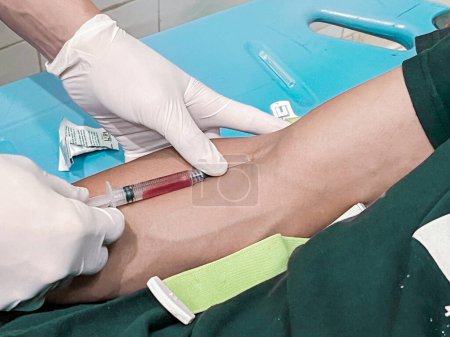 Foto de Un enfermero está inyectando un analgésico anestésico en la mano de un paciente. - Imagen libre de derechos