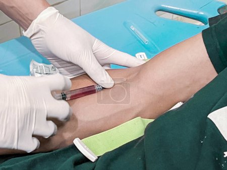 Foto de Un enfermero está inyectando un analgésico anestésico en la mano de un paciente. - Imagen libre de derechos