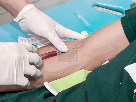 Téléchargez les photos : Une infirmière injecte un analgésique dans la main d'un patient. - en image libre de droit