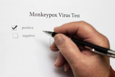 Results of monkeypox virus test on white paper...
