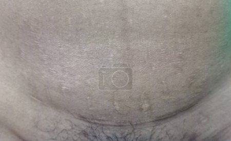Foto aus dem Bauch einer Frau nach einem Kaiserschnitt.