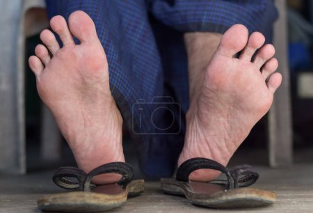 Foto de Pie de hombre adulto asiático. Concepto de cuidado de los pies, dolor y salud. - Imagen libre de derechos