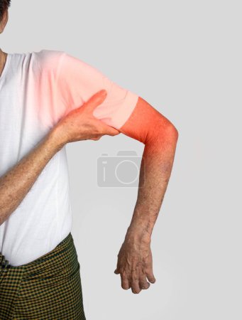 Photo for Pain in the upper arm and shoulder joint of Southeast Asian old man. Concept of frozen shoulder. - Royalty Free Image