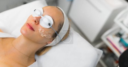 Foto de Close-up of a female face prepared for a thermolifting facial procedure. Beauty concept. High quality photo - Imagen libre de derechos