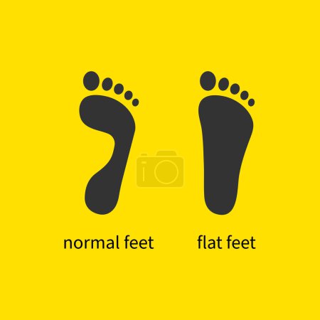 Ilustración de Pies planos y logo de pie saludable. Icono plano - Imagen libre de derechos