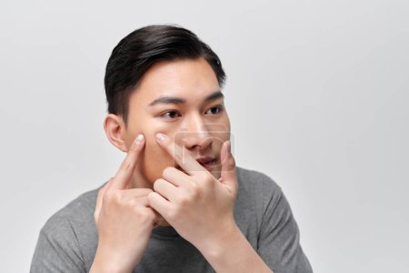 Photo for Handsome man touching his face. Squeezing pimple. - Royalty Free Image
