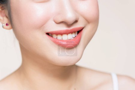Foto de Recortado foto de cerca de los labios de la mujer hermosa con corrección de forma - Imagen libre de derechos