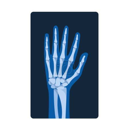 Ilustración de Las imágenes de rayos X de la mano revelan estructuras óseas internas, articulaciones y anormalidades, lo que ayuda a diagnosticar fracturas, artritis y otras afecciones ortopédicas. Ilustración de vectores de dibujos animados - Imagen libre de derechos
