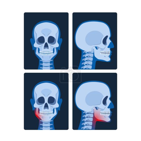 Ilustración de Las radiografías de la cabeza, o las radiografías craneales, revelan imágenes detalladas del cráneo y el cerebro, ayudando en el diagnóstico de fracturas, tumores o afecciones neurológicas. Ilustración de vectores de dibujos animados - Imagen libre de derechos