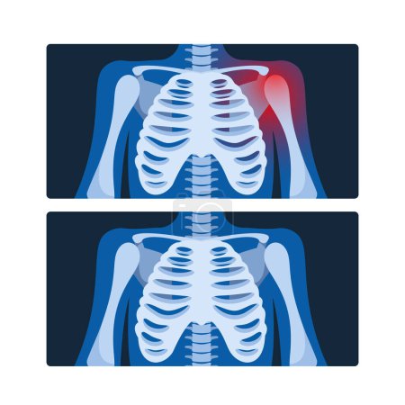 Ilustración de Radiografía de tórax, captura imágenes de los pulmones y estructuras circundantes, ayuda en el diagnóstico de afecciones respiratorias y detección de anomalías. Ilustración de vectores de dibujos animados - Imagen libre de derechos