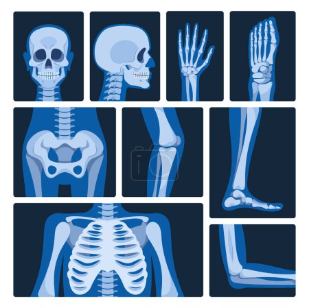 Illustration for X-ray Pictures Vector Set. Medical Images Produced By Exposing The Body To Xrays, Revealing Internal Structures For Diagnostic Purposes, Such As Detecting Fractures Or Assessing Organ Health - Royalty Free Image