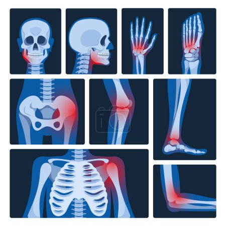 Illustration for X-ray Pictures Vector Set. Medical Images Revealing Internal Structures Of The Body. They Help Diagnose Conditions By Capturing Shadows Formed As Xrays Pass Through Tissues Of Varying Densities - Royalty Free Image