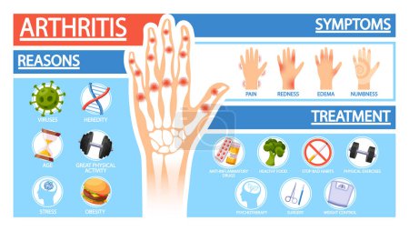 Illustration for Arthritis Symptoms, Reasons and Treatment or Prevention Of The Disease, Risk Factors And Management Strategies. Vector Medical Poster with X-ray Of The Sick Hands with Pain, Redness, Edema or Numbness - Royalty Free Image