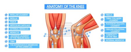 Vektor-Anatomie des Kniegelenks Infografisches Poster, das Strukturen des Kniegelenks zeigt, einschließlich Knochen wie Femur, Tibia, Patella, Bänder, Knorpel und Muskeln, um das Verständnis zu fördern