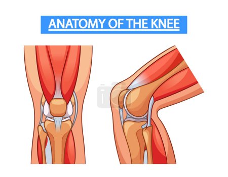 Infografías de vectores médicos que detallan la anatomía de la articulación de la rodilla, mostrando huesos, ligamentos, cartílago y músculos, con etiquetas y imágenes concisas para mayor claridad y comprensión educativa