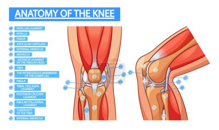 Illustration for Anatomy Of Knee Joint Medical Infographic Poster. Patella, Femur, Articular Cartilage. External or Internal Meniscus, Tibia, Patellar, Tibial, Collagen Ligament. Anterior Ligament of the Fibular Head - Royalty Free Image