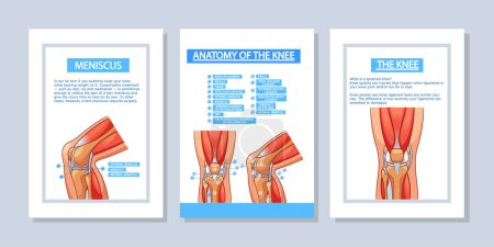 Illustration for Vector Medical Poster Templates Illustrate Knee Joint Anatomy. Vertical Banners or Flyers Showcasing Ligaments, Tendons, Cartilage, And Bones For Educational Reference And Clinical Understanding - Royalty Free Image