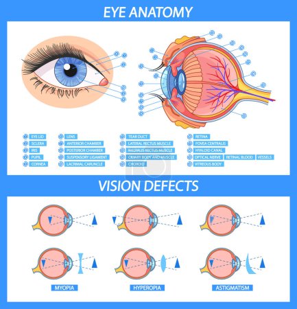 Infografía vectorial completa que muestra la anatomía ocular con piezas etiquetadas y defectos de visión comunes. Guía visual incluye detalles de los componentes oculares y condiciones como la miopía, la hipermetropía y el estigmatismo