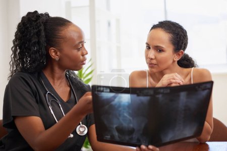 Photo for Black female doctor holds x-ray and explains diagnosis to worried patient. High quality photo - Royalty Free Image