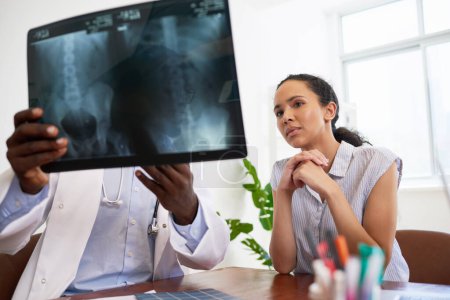 Foto de El médico varón negro explica los resultados de los rayos X a un paciente joven y preocupado en el consultorio médico. Foto de alta calidad - Imagen libre de derechos