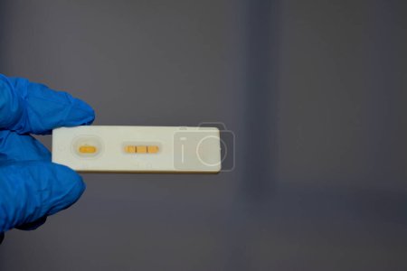 Foto de Positive urine pregnancy test, Human chorionic gonadotropin (hCG), a hormone for maternal recognition of pregnancy produced by trophoblast cells which surrounding a growing embryo syncytiotrophoblast - Imagen libre de derechos