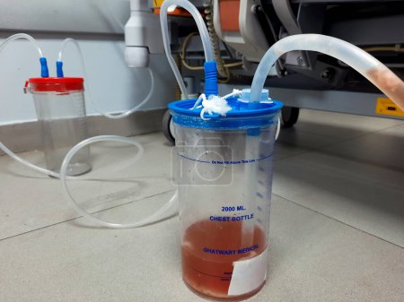 Photo for Cairo, Egypt, August 2 2023: Ghatwary medical chest bottle 2000ml, drainage from a chest tube of aspiration pneumonia case resulted in pleural effusion and empyema, fluid has pus, fibers and blood - Royalty Free Image