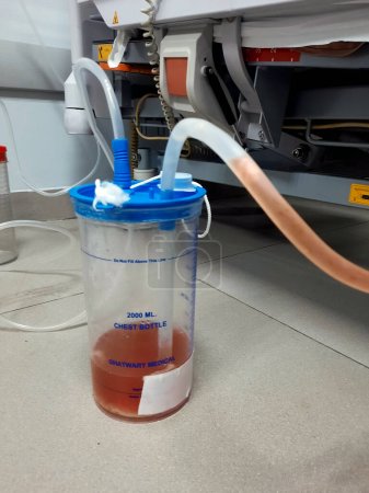 Photo for Cairo, Egypt, August 2 2023: Ghatwary medical chest bottle 2000ml, drainage from a chest tube of aspiration pneumonia case resulted in pleural effusion and empyema, fluid has pus, fibers and blood - Royalty Free Image