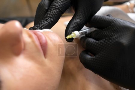 Photo for Doctor cosmetologist with syringe makes injection of botulinum toxin into chin of unrecognized female patient in cosmetology clinic, beauty treatment in cosmetology. Horizontal plane. - Royalty Free Image