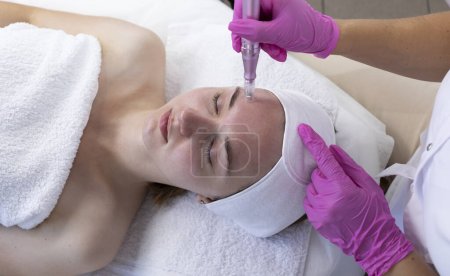 Foto de Top View Cosmetólogo haciendo la inyección de mesoterapia con Dermapen en la cara de la mujer joven para el rejuvenecimiento en el centro de spa. Paciente recibiendo mesoterapia con aguja, cuidado de la piel. Plano horizontal. - Imagen libre de derechos