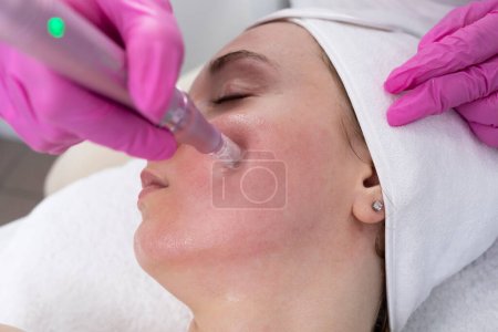 Photo for Closeup Cosmetologist Making Mesotherapy Injection With Dermapen On Face, Cheek Area Of Young Woman For Rejuvenation In Spa Center. Patient Getting Needle Mesotherapy, Skincare. Horizontal Plane. - Royalty Free Image