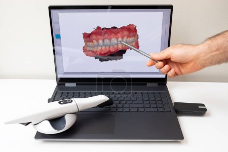 Zahnarzt zeigt 3D-gescannte Bilder von gescannten Zähnen auf dem Monitor des Computers, weißer 3D-Intraoralzahnscanner auf dem Tisch liegend. Zahnausrüstung, Gerät zum Scannen von Zähnen. Zahnmedizin. Horizontal