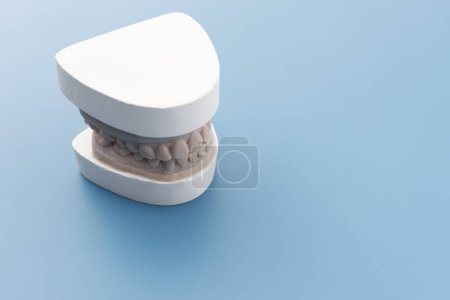 Photo for Dental Mold, Gypsum Model Plaster Cast For Teeth Molar In Laboratory On Blue Background. Human Jaw. Preparing Invisible Braces, Aligner Or Night Guard For Bruxism, Dentures. Copy Space For Text - Royalty Free Image