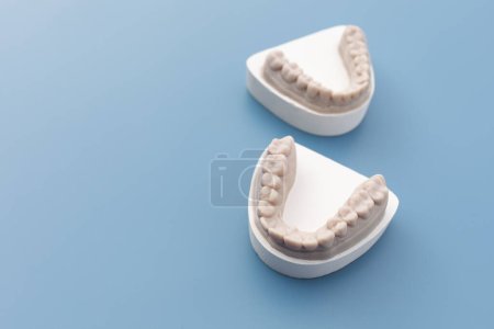 Photo for Gypsum Model Plaster For Teeth Molar, Dental Mold In Laboratory On Blue Background. Human Jaw. Tooth Cast For Invisible Braces, Aligner Or Night Guard For Bruxism, Dentures. Copy Space For Text - Royalty Free Image