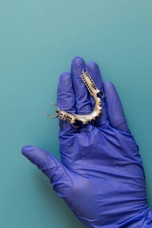 Metal Frame Lower Partial Denture, Cobalt Chrome Dental Plate, Bridge Printed By 3d Printer in Doctors Hand. Blue Background. Flat Lay Mockup. Copy Space For Text. Vertical Plane. Dentistry.