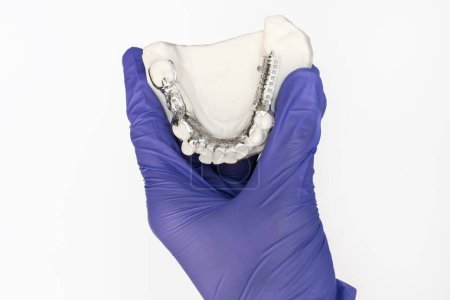Isolated Metal Frame Lower Partial Denture with Die Stone, Plaster Cast Molds Of Lower Jaws in Gloved Human Hand on White Background, Cobalt Chrome Dental Plate, 3D Printed Bridge. Horizontal Plane