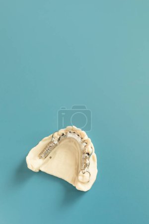 Mockup Metal Frame Lower Parcial Denture, Plate On Die Stone, Molde de yeso de mandíbulas inferiores, Placa dental de cobalto cromado, Puente impreso en 3D Mockup sobre fondo azul. Copiar espacio. Vertical plano.