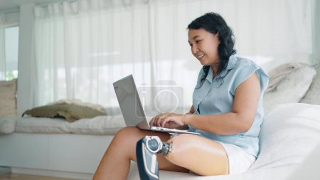 Téléchargez les photos : Femmes asiatiques adultes avec prothèse jambe dactylographier sur ordinateur portable pour travailler en ligne ou bavarder assis sur un canapé confortable dans la chambre. Équipement de prothèse de jambe, concept Amputé - en image libre de droit
