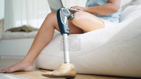 Foto de Cierre la pierna protésica de las mujeres amputadas trabajando y escribiendo en el ordenador portátil mientras están sentadas en la sala de estar en casa. Equipos protésicos para piernas, concepto de amputado - Imagen libre de derechos