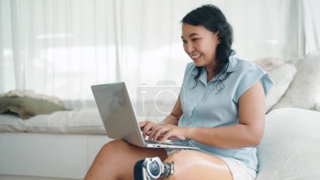 Foto de Adulto asiático mujeres con prótesis pierna mecanografía en el ordenador portátil para trabajar en línea o charlando sentado en cómodo sofá en el dormitorio. Equipos protésicos para piernas, concepto de amputado - Imagen libre de derechos